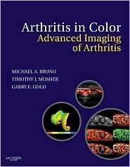   Arthritis, (1416047220), Michael A. Bruno, Textbooks   