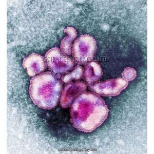 Avian influenza virus particles, TEM Framed Prints