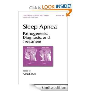 Sleep Apnea Pathogenesis, Diagnosis, and Treatment PACK  