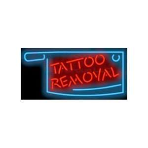 Tattoo Removal Neon Sign