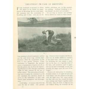  1905 Treatment in Case of Drowning Life Saving Methods 